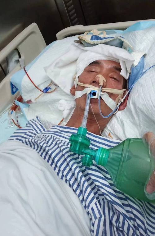 爱心接力！求大家救救突发脑溢血的父亲，我该怎么办？